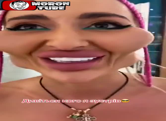 Video :After her operation, she has completely changed!